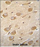 14 - CNGA4 Antibody  (N-term) AP11811a