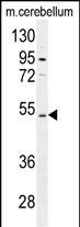 1 - CNGA4 Antibody  (N-term) AP11811a