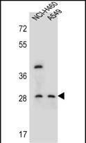 1 - SPATS1 Antibody (Center) AP11817c