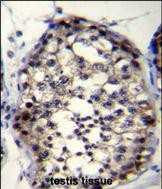 14 - ROPN1L Antibody (N-term) AP11844a