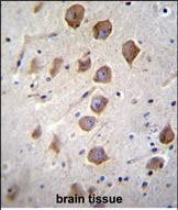 14 - KCNRG Antibody (C-term) AP11851b