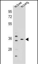 1 - KCNRG Antibody (C-term) AP11851b