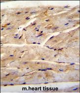 14 - RMD1 Antibody  (N-term) AP11887a
