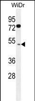 1 - RMD1 Antibody  (N-term) AP11887a