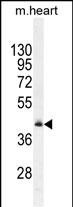 1 - RMD1 Antibody  (N-term) AP11887a