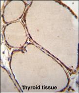 14 - NFKBID Antibody (N-term) AP11893a
