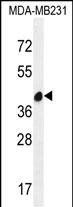 1 - LRRC72 Antibody (C-term) AP11910b