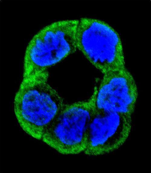 3 - UNQ5814 Antibody (C-term) AP11911b