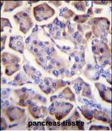 14 - UNQ5814 Antibody (C-term) AP11911b