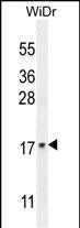 1 - UNQ5814 Antibody (C-term) AP11911b