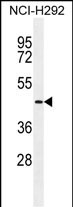 1 - TMPRSS11E2 Antibody (Center) AP11923c