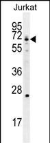 1 - GCLC Antibody (N-term) AP11943a