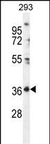 1 - FOLR4 Antibody (N-term) AP11990a