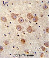14 - FUSSEL18 Antibody (C-term) AP11997b