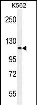 1 - FUSSEL18 Antibody (C-term) AP11997b