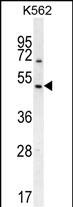 1 - RGS7 Antibody (C-term) AP12015b