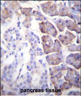 14 - CPB1 Antibody (N-term) AP12023a