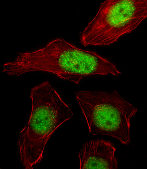 3 - PURB Antibody (C-term) AP12051B