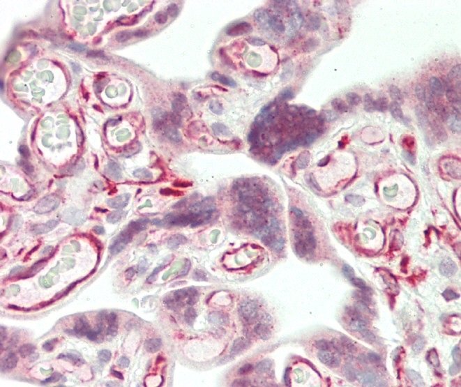 14 - WRN Antibody (Center T802) AP12078C