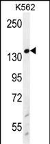 1 - WRN Antibody (Center T802) AP12078C