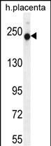 1 - RUSC2 Antibody (N-term) AP12095a