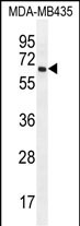 1 - PRAMEF20 Antibody (C-term) AP12142b