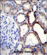14 - NKD2 Antibody (C-term) AP12158B