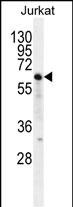 1 - NKD2 Antibody (C-term) AP12158B