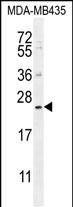 1 - FAM109A Antibody (N-term) AP12167a