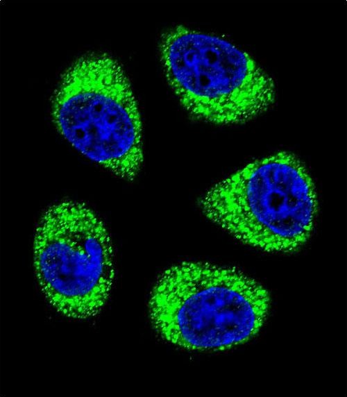 3 - SLC25A6 Antibody (Center) AP12188C
