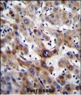 14 - SLC25A6 Antibody (Center) AP12188C