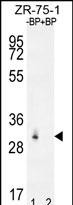 1 - RAB40AL Antibody (N-term) AP12011a