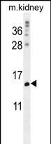 1 - MORN5 Antibody (C-term) AP12205b