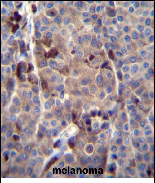 14 - PRAMEF8 Antibody (C-term) AP12211b