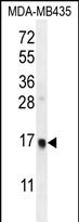 1 - UNQ6493 Antibody (C-term) AP12222b