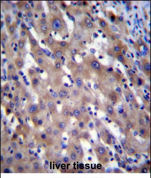 14 - RPGR Antibody (C-term) AP12226b