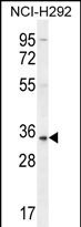 1 - SFTPA2B Antibody (C-term) AP12232b
