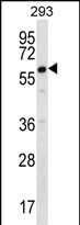 1 - DAZ2 Antibody (C-term) AP12295b