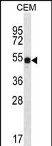 1 - DAZ3 Antibody (C-term) AP12305b