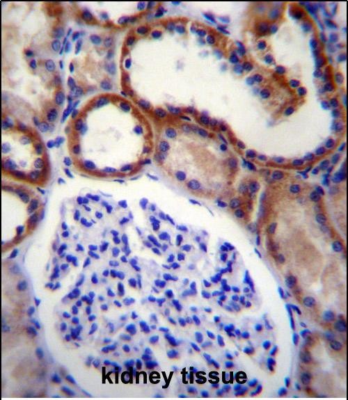 14 - MAP3K15 Antibody (N-term) AP12323c