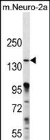 1 - MAP3K15 Antibody (N-term) AP12323c