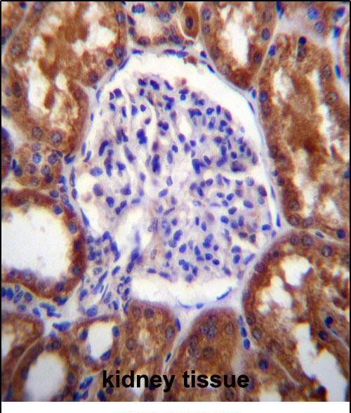 14 - SLC12A6 Antibody (N-term) AP12382a