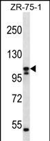 1 - SLC12A6 Antibody (N-term) AP12382a