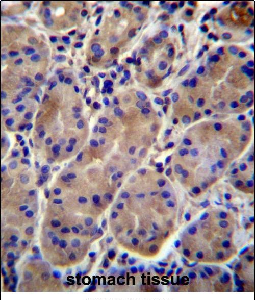 14 - KCNJ13 Antibody (N-term) AP12387a