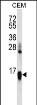 1 - HIST1H2AA Antibody (N-term) AP12399a