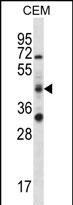 1 - RBM42 Antibody (C-term) AP12424b
