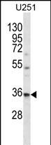 1 - VPS37B Antibody (Center) AP12426C
