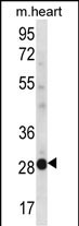 1 - NCCRP1 Antibody (C-term) AP12510B