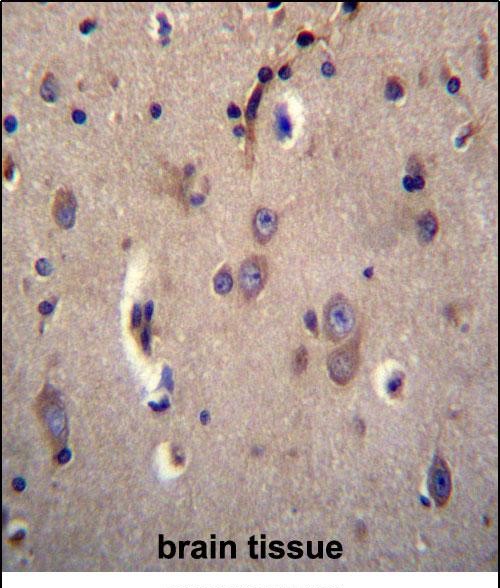 14 - DTNA Antibody (C-term) AP12573B