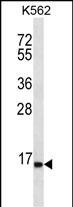 1 - SPINK8 Antibody (C-term) AP12598b